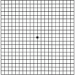 Age-Related Macular Degeneration