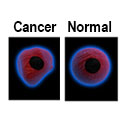 banner-125-125-cancer-normal-cells